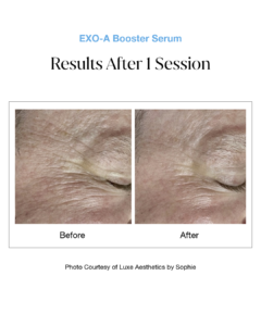EXO-A Booster Serum B&A