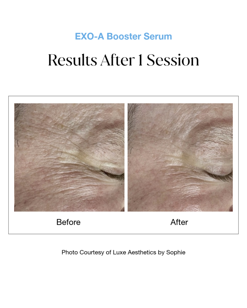 EXO-A Booster Serum B&A